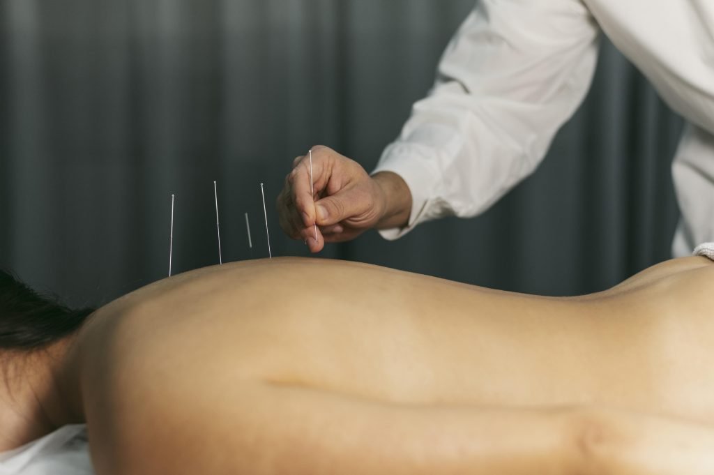 Acupuncturist in hellevoetsluis